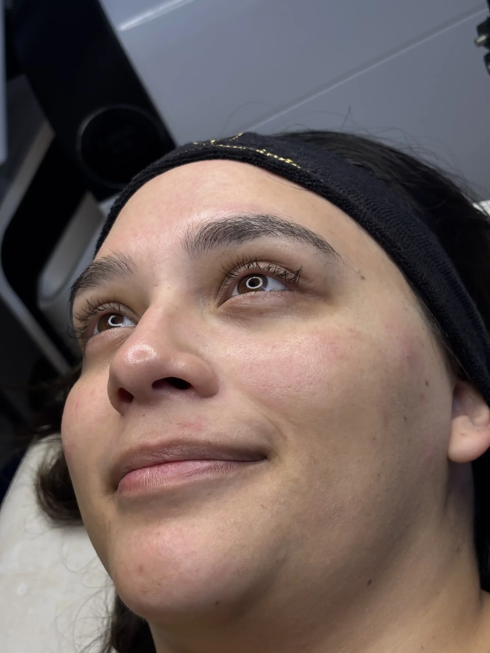 Hollywood Peeling - Fase de Renovación