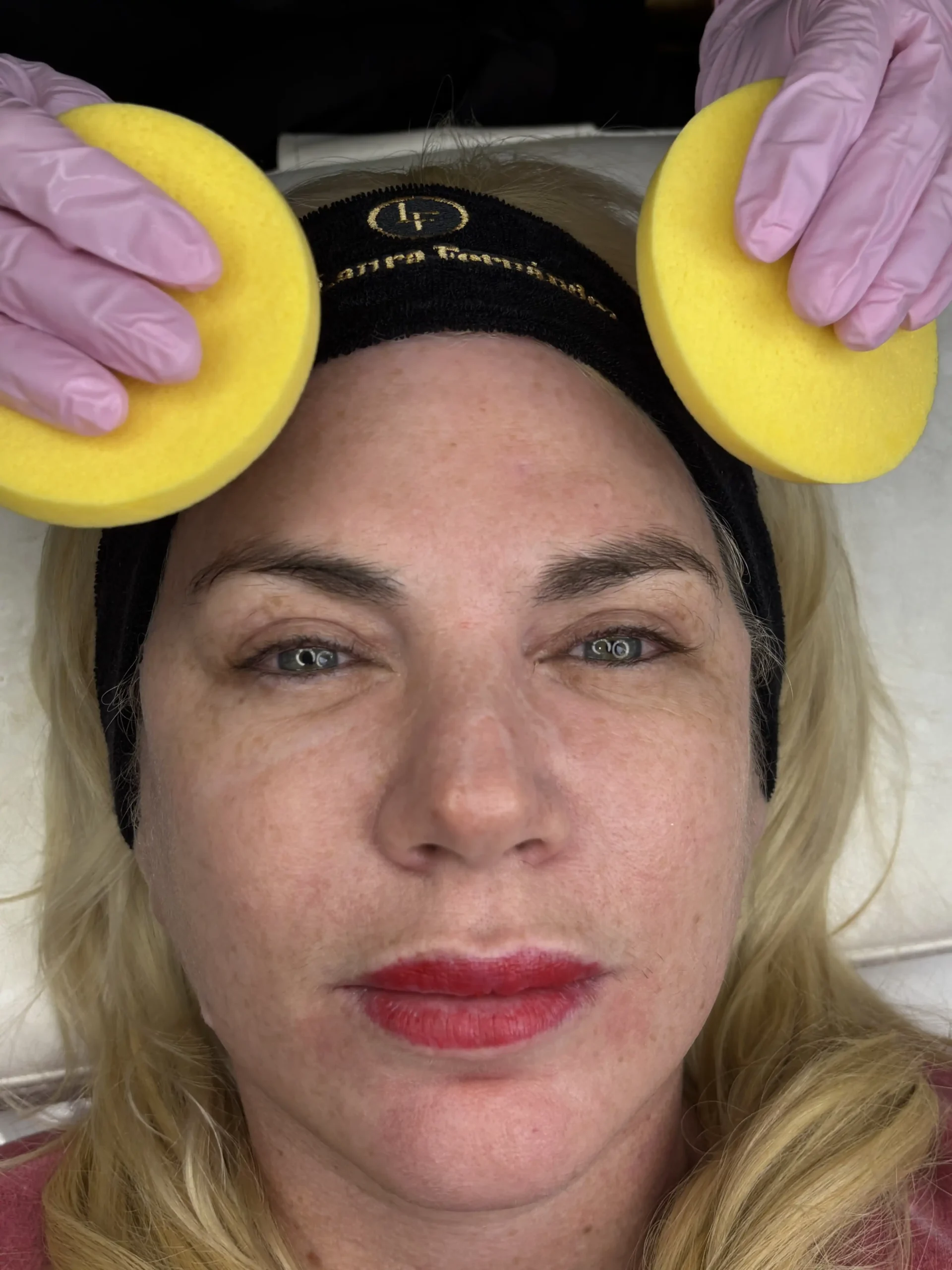 Limpieza Facial - Preparación de Piel