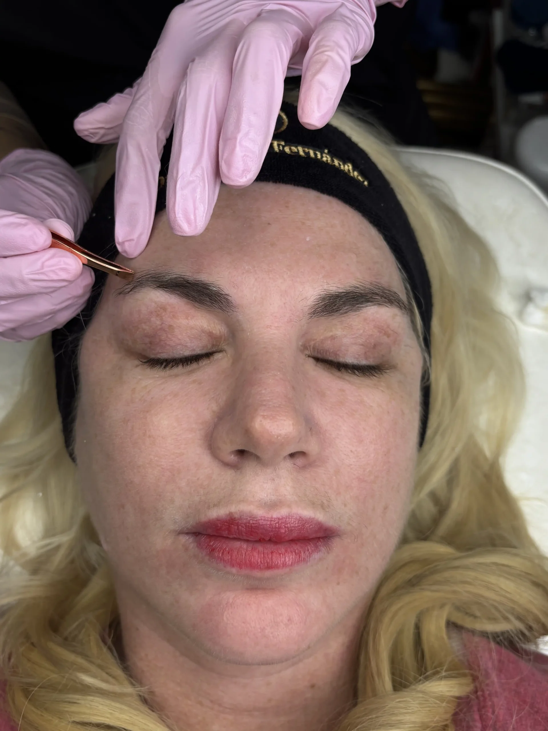 Limpieza Facial - Extracción y Cuidado